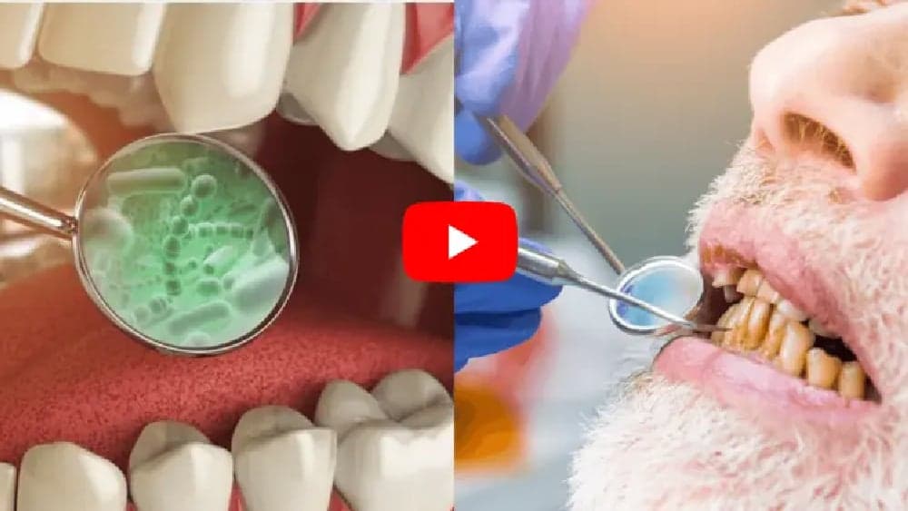 Let This "Soft Mineral" Melt In Your Mouth To Regrow Gums & Teeth