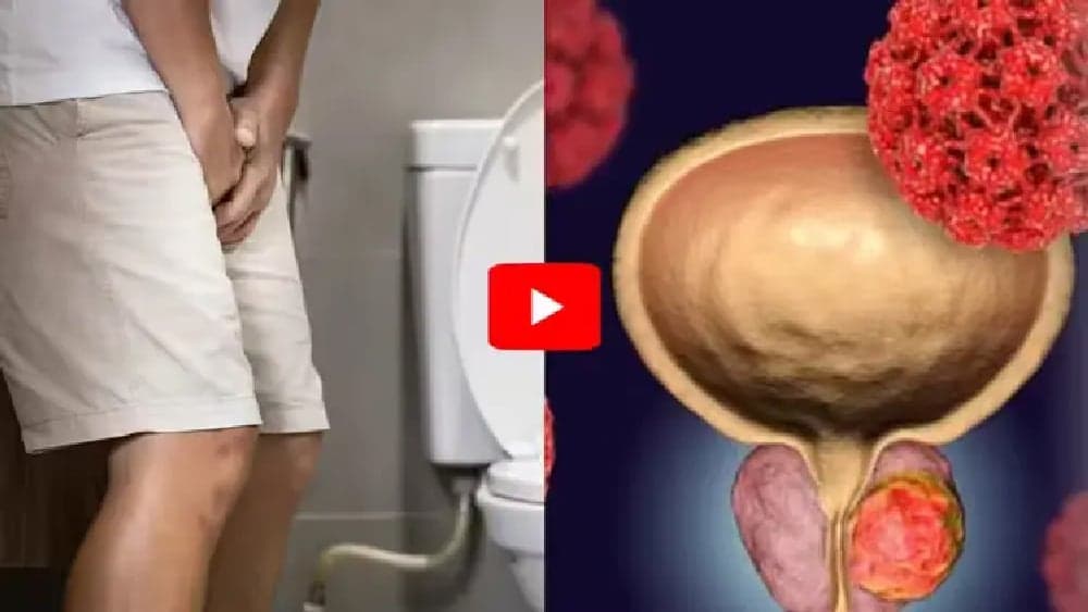 Top Urologist: Do This to Help Shrink Enlarged Prostate